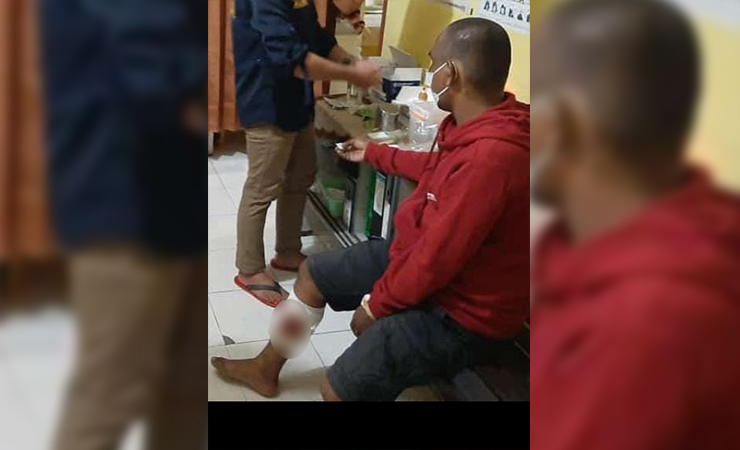TANGKAP | Seorang pelaku Curanmor berinisial HH yang dilumpuhkan polisi dengan 'timah panas' mendapat perawatan medis. (Foto: Ist/Seputarpapua)