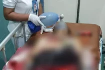 Korban saat mendapatkan pertolongan medis di Rumah Sakit Dian Harapan. (Foto: Ist)